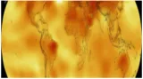 Living in a hotter world