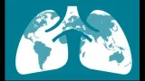 Feed the cure  on paying tb patients