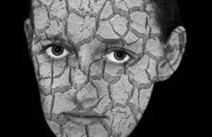 A new discovery about human skin could help us eliminate scarring 