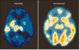 Long term depression permanently changes the brain