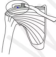 Impinged  - (To produce an effect, usually an unwanted one)