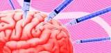 Scientists who stick needles in brains curious about what needles do to brains3