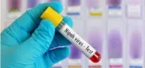 The nipah test