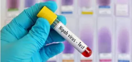 The nipah test