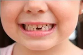 Lacuna  - A gap or missing part.