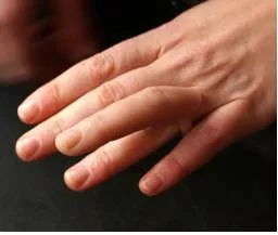 Appendage  - A thing that is added or attached to something larger or more important.