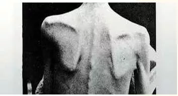 Atrophy  - Meaning-  Gradually decline in effectiveness or vigour due to underuse or neglect.