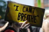 The anatomy of anti black racism