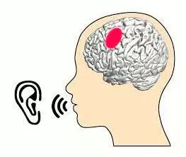 Articulation  - The formation of clear and distinct sounds in speech.