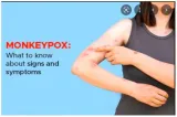 Time for vigilance  on monkeypox cases in india