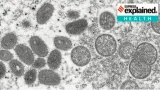 Explained  second case of monkeypox confirmed in kerala  is there a risk of an outbreak in india 