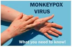 Unpacking a conundrum  on potential severity of monkeypox