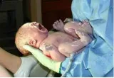 The consequences of declining fertility are many