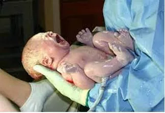 The consequences of declining fertility are many