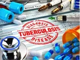India must fine tune its strategy to eliminate tuberculosis