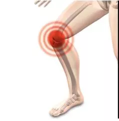 Osteoarthritis  here's how stem cell therapy works as pain relief to heal knee joint swelling