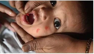What the measles outbreak in india reveals