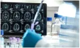 It’s just a first step  but this new alzheimer’s drug could be a huge breakthrough