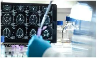 It’s just a first step  but this new alzheimer’s drug could be a huge breakthrough