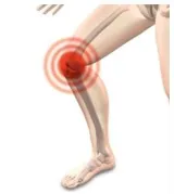 Osteoarthritis  here's how stem cell therapy works as pain relief to heal knee joint swelling