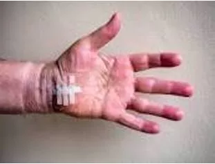 Flays - Strip the skin off (a corpse or carcass).