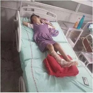 Stray dog attacks girl  father blames mcd  agency denies charge