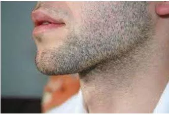 Stubble meaning