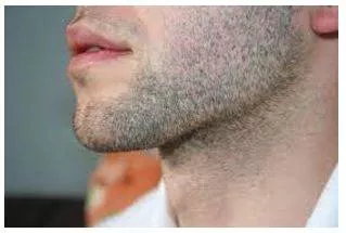 Stubble meaning