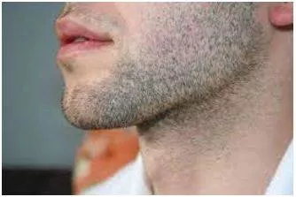 Stubble meaning