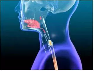 Swallow - Cause or allow (something, especially food or drink) to pass down the throat.
