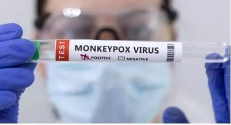 Monkeypox outbreak in africa is just the ‘tip of the iceberg’ as who declares a global health emergency