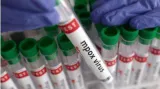One mpox case found in uganda prison  official says
