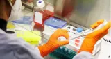 Germany reports first case of new and more infectious mpox variant
