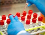 $25 mn pandemic fund goes to curb ‘zoonotic’ diseases