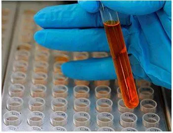Research scholars upset over dst delay in release of stipend
