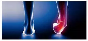 Straining - Force (a part of one's body or oneself) to make an unusually great effort.