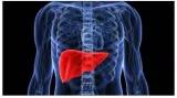 Can fatty liver disease affect children  doctor busts 3 myths  shares facts