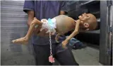 Five month old starved to death in gaza war  weighing less than at birth
