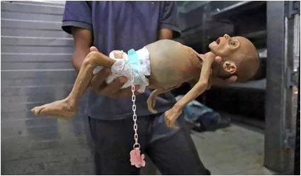 Five month old starved to death in gaza war  weighing less than at birth