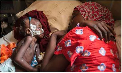 Conflict  poverty  climate change fuel nigeria’s worsening malnutrition crisis
