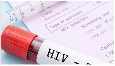 Mizoram records 29 96 hiv related deaths  over 11 000 new cases since 2020