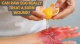 Does egg white really heal burn wounds doctors warn of deadly infection risk