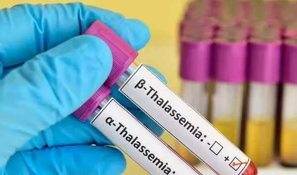 Thalassaemia patients hail new transfusion bill