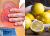 7 everyday foods that can help prevent kidney stones forming