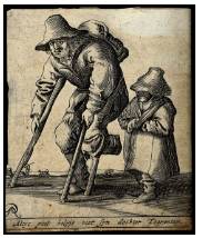 Cripple  - To cause severe or permanent injury to.