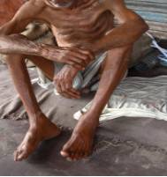 Gaunt  - Very thin, especially because of sickness or hunger.