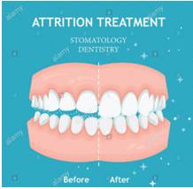 Attrition  - A gradual weakening, loss, or destruction.