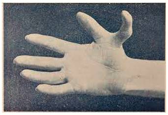 Supernumerary  - Not wanted or needed.