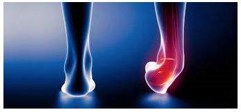 Strains - Force (a part of one's body or oneself) to make an unusually great effort.