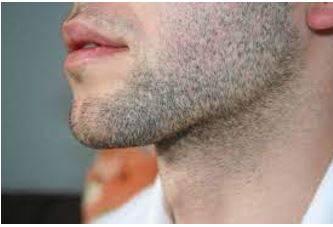 Stubble - The very short hairs on someone's skin when they have not shaved recently,